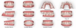 tipos de ortodoncias en Clinica Tello